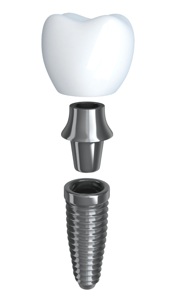 dental implants in East Hanover New Jersey