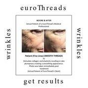 EuroThread Lift is a Non Surgical Facelift