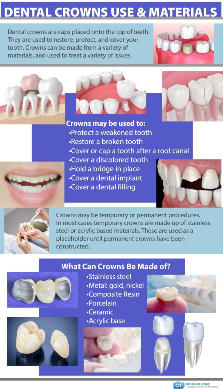Dental Crown uses infographic