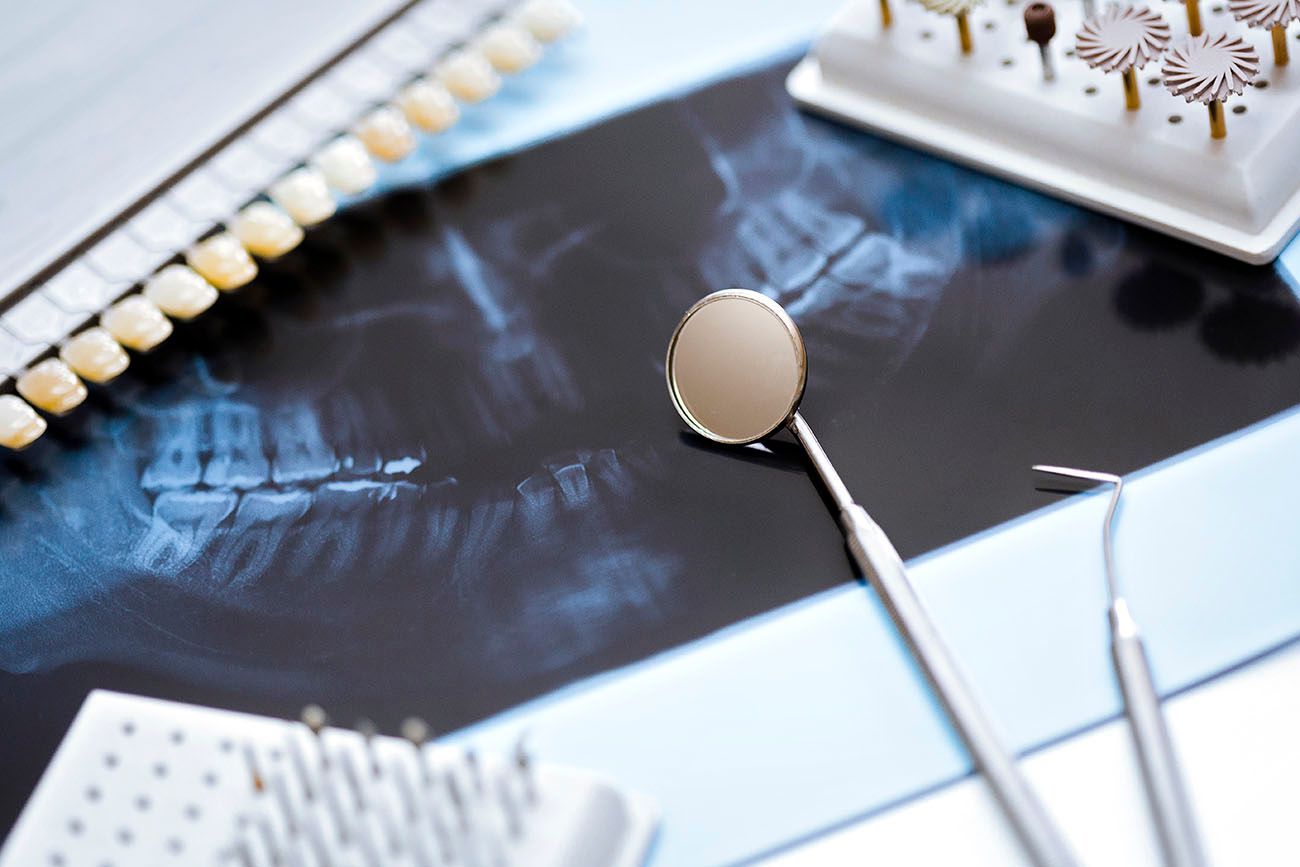 The Importance of Dental Exams